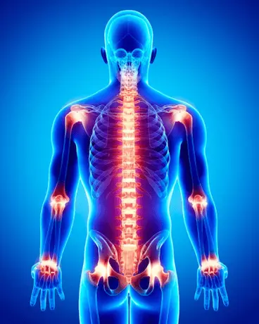 Healthy joints